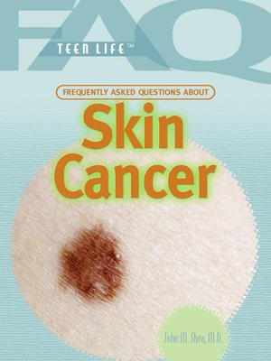 cover image of Frequently Asked Questions About Skin Cancer